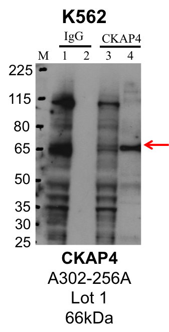 K562_Bethyl_A302-256A_1_CKAP4.png<br>Caption: IP-Western Blot analysis of K562 whole cell lysate using CKAP4 specific antibody. Lane 1 is 1% of twenty million whole cell lysate input and lane 2 is 25% of IP enrichment using rabbit normal IgG (lanes under 'IgG'). Lane 3 is 1% of twenty million whole cell lysate input and lane 4 is 10% IP enrichment using rabbit polyclonal anti-CKAP4 antibody (lanes under 'CKAP4').