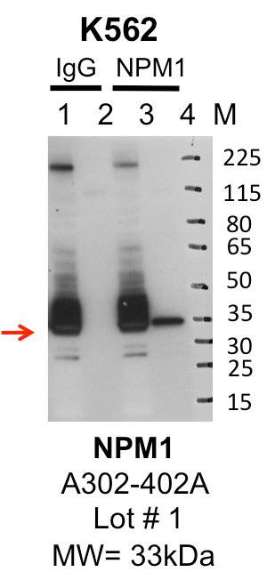 K562_Bethyl_A302-402A_1_NPM1.png<br>Caption: IP-Western Blot analysis of K562 whole cell lysate using NPM1 specific antibody. Lane 1 is 1% of twenty million whole cell lysate input and lane 2 is 25% of IP enrichment using rabbit normal IgG (lanes under 'IgG'). Lane 3 is 1% of twenty million whole cell lysate input and lane 4 is 10% IP enrichment using rabbit polyclonal anti-NPM1 antibody (lanes under 'NPM1').