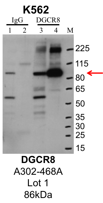 K562_Bethyl_A302-468A_1_DGCR8.png<br>Caption: IP-Western Blot analysis of K562 whole cell lysate using DGCR8 specific antibody. Lane 1 is 1% of twenty million whole cell lysate input and lane 2 is 25% of IP enrichment using rabbit normal IgG (lanes under 'IgG'). Lane 3 is 1% of twenty million whole cell lysate input and lane 4 is 10% IP enrichment using rabbit polyclonal anti-DGCR8 antibody (lanes under 'DGCR8').