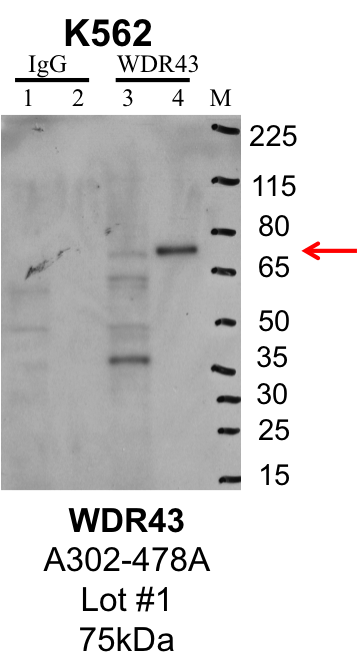 K562_Bethyl_A302-478A_1_WDR43.png<br>Caption: IP-Western Blot analysis of K562 whole cell lysate using WDR43 specific antibody. Lane 1 is 1% of twenty million whole cell lysate input and lane 2 is 25% of IP enrichment using rabbit normal IgG (lanes under 'IgG'). Lane 3 is 1% of twenty million whole cell lysate input and lane 4 is 10% IP enrichment using rabbit polyclonal anti-WDR43 antibody (lanes under 'WDR43').