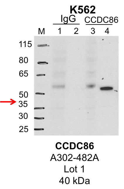 K562_Bethyl_A302-492A_1_CCDC86.png<br>Caption: IP-Western Blot analysis of K562 whole cell lysate using CCDC86 specific antibody. Lane 1 is 1% of twenty million whole cell lysate input and lane 2 is 25% of IP enrichment using rabbit normal IgG (lanes under 'IgG'). Lane 3 is 1% of twenty million whole cell lysate input and lane 4 is 10% IP enrichment using rabbit polyclonal anti-CCDC86 antibody (lanes under 'CCDC86').