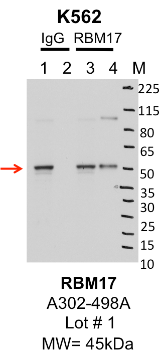 K562_Bethyl_A302-498A_1_RBM17.png<br>Caption: IP-Western Blot analysis of K562 whole cell lysate using RBM17 specific antibody. Lane 1 is 1% of twenty million whole cell lysate input and lane 2 is 25% of IP enrichment using rabbit normal IgG (lanes under 'IgG'). Lane 3 is 1% of twenty million whole cell lysate input and lane 4 is 10% IP enrichment using rabbit polyclonal anti-RBM17 antibody (lanes under 'RBM17').