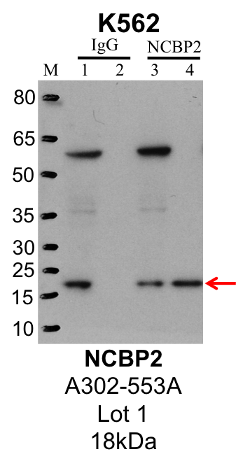 K562_Bethyl_A302-553A_1_NCBP2.png<br>Caption: IP-Western Blot analysis of K562 whole cell lysate using NCBP2 specific antibody. Lane 1 is 1% of twenty million whole cell lysate input and lane 2 is 25% of IP enrichment using rabbit normal IgG (lanes under 'IgG'). Lane 3 is 1% of twenty million whole cell lysate input and lane 4 is 10% IP enrichment using rabbit polyclonal anti-NCBP2 antibody (lanes under 'NCBP2').