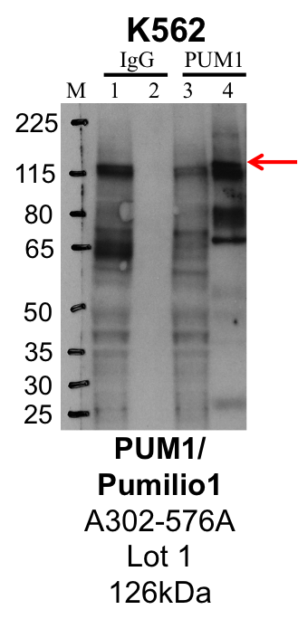 K562_Bethyl_A302-576A_1_PUM1.png<br>Caption: IP-Western Blot analysis of K562 whole cell lysate using PUM1 specific antibody. Lane 1 is 1% of twenty million whole cell lysate input and lane 2 is 25% of IP enrichment using rabbit normal IgG (lanes under 'IgG'). Lane 3 is 1% of twenty million whole cell lysate input and lane 4 is 10% IP enrichment using rabbit polyclonal anti-PUM1 antibody (lanes under 'PUM1').