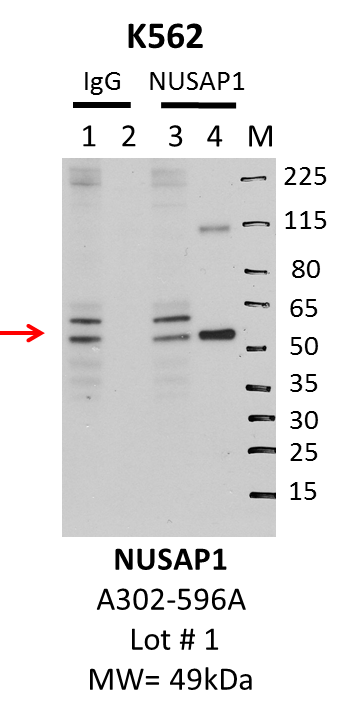 K562_Bethyl_A302-596A_1_NUSAP1.png<br>Caption: IP-Western Blot analysis of K562 whole cell lysate using NUSAP1 specific antibody. Lane 1 is 1% of twenty million whole cell lysate input and lane 2 is 10% of IP enrichment using rabbit normal IgG (lanes under 'IgG'). Lane 3 is 1% of twenty million whole cell lysate input and lane 4 is 10% IP enrichment using rabbit polyclonal anti-NUSAP1 antibody (lanes under 'NUSAP1').