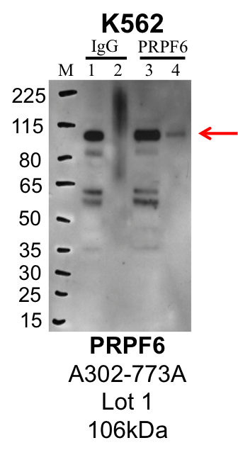 K562_Bethyl_A302-773A_1_PRPF6.png<br>Caption: IP-Western Blot analysis of K562 whole cell lysate using PRPF6 specific antibody. Lane 1 is 1% of twenty million whole cell lysate input and lane 2 is 25% of IP enrichment using rabbit normal IgG (lanes under 'IgG'). Lane 3 is 1% of twenty million whole cell lysate input and lane 4 is 10% IP enrichment using rabbit polyclonal anti-PRPF6 antibody (lanes under 'PRPF6').