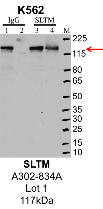 K562_Bethyl_A302-834A_1_SLTM.png<br>Caption: IP-Western Blot analysis of K562 whole cell lysate using SLTM specific antibody. Lane 1 is 1% of twenty million whole cell lysate input and lane 2 is 25% of IP enrichment using rabbit normal IgG (lanes under 'IgG'). Lane 3 is 1% of twenty million whole cell lysate input and lane 4 is 10% IP enrichment using rabbit polyclonal anti-SLTM antibody (lanes under 'SLTM').