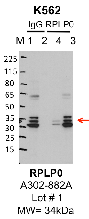 K562_Bethyl_A302-882A_1_RPLP0.png<br>Caption: IP-Western Blot analysis of K562 whole cell lysate using RPLP0 specific antibody. Lane 1 is 1% of twenty million whole cell lysate input and lane 2 is 25% of IP enrichment using rabbit normal IgG (lanes under 'IgG'). Lane 3 is 1% of twenty million whole cell lysate input and lane 4 is 10% IP enrichment using rabbit polyclonal anti-RPLP0 antibody (lanes under 'RPLP0').