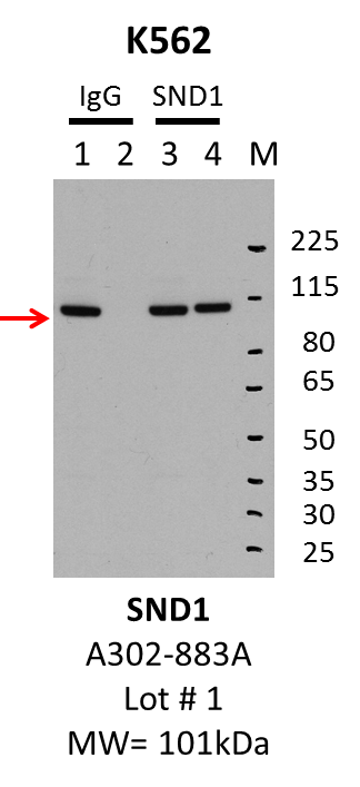 K562_Bethyl_A302-883A_1_SND1.png<br>Caption: IP-Western Blot analysis of K562 whole cell lysate using SND1 specific antibody. Lane 1 is 1% of twenty million whole cell lysate input and lane 2 is 10% of IP enrichment using rabbit normal IgG (lanes under 'IgG'). Lane 3 is 1% of twenty million whole cell lysate input and lane 4 is 10% IP enrichment using rabbit polyclonal anti-SND1 antibody (lanes under 'SND1').