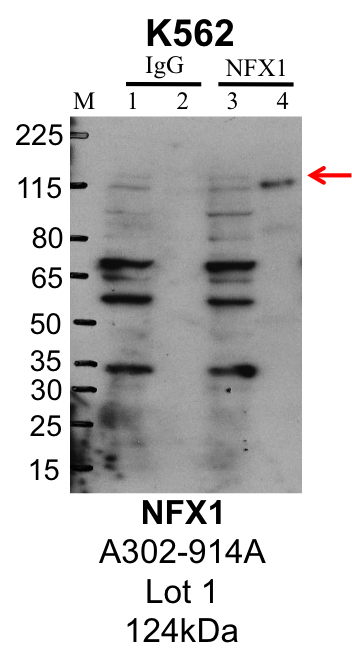 K562_Bethyl_A302-914A_1_NFX1.png<br>Caption: IP-Western Blot analysis of K562 whole cell lysate using NFX1 specific antibody. Lane 1 is 1% of twenty million whole cell lysate input and lane 2 is 25% of IP enrichment using rabbit normal IgG (lanes under 'IgG'). Lane 3 is 1% of twenty million whole cell lysate input and lane 4 is 10% IP enrichment using rabbit polyclonal anti-NFX1 antibody (lanes under 'NFX1').