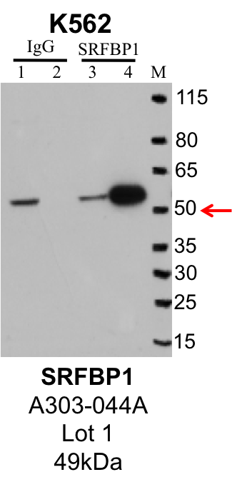 K562_Bethyl_A303-044A_1_SRFBP1.png<br>Caption: IP-Western Blot analysis of K562 whole cell lysate using SRFBP specific antibody. Lane 1 is 1% of twenty million whole cell lysate input and lane 2 is 25% of IP enrichment using rabbit normal IgG (lanes under 'IgG'). Lane 3 is 1% of twenty million whole cell lysate input and lane 4 is 10% IP enrichment using rabbit polyclonal anti-SRFBP antibody (lanes under 'SRFBP').