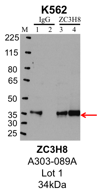 K562_Bethyl_A303-089A_1_ZC3H8.png<br>Caption: IP-Western Blot analysis of K562 whole cell lysate using ZC3H8 specific antibody. Lane 1 is 1% of twenty million whole cell lysate input and lane 2 is 25% of IP enrichment using rabbit normal IgG (lanes under 'IgG'). Lane 3 is 1% of twenty million whole cell lysate input and lane 4 is 10% IP enrichment using rabbit polyclonal anti-ZC3H8 antibody (lanes under 'ZC3H8').