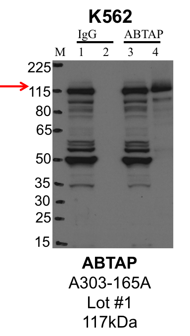 K562_Bethyl_A303-165A_1_ABTAP.png<br>Caption: IP-Western Blot analysis of K562 whole cell lysate using ABTAP specific antibody. Lane 1 is 1% of twenty million whole cell lysate input and lane 2 is 25% of IP enrichment using rabbit normal IgG (lanes under 'IgG'). Lane 3 is 1% of twenty million whole cell lysate input and lane 4 is 10% IP enrichment using rabbit polyclonal anti-ABTAP antibody (lanes under 'ABTAP').