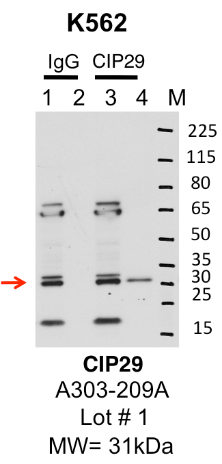 K562_Bethyl_A303-209A_1_CIP29.png<br>Caption: IP-Western Blot analysis of K562 whole cell lysate using CIP29 specific antibody. Lane 1 is 1% of twenty million whole cell lysate input and lane 2 is 25% of IP enrichment using rabbit normal IgG (lanes under 'IgG'). Lane 3 is 1% of twenty million whole cell lysate input and lane 4 is 10% IP enrichment using rabbit polyclonal anti-CIP29 antibody (lanes under 'CIP29').