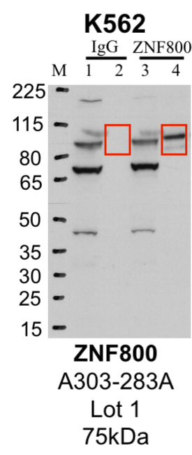 K562_Bethyl_A303-283A_1_ZNF800.png<br>Caption: Representative image of immunoprecipitation performed on whole cell extracts from the K562 cell line using the ZNF800-specific antibody A303-283A. Lane 1: Input from IP using control IgG. Lane 2: Immunoprecipitated material using control IgG. Lane 3: Input from IP using ZNF800 antibody. Lane 4: Immunoprecipitated material using ZNF800 antibody. Outlined regions were excised from gel and subjected to analysis by mass spectrometry. Target molecular weight: 75 kDa.