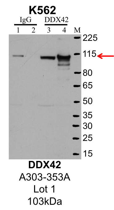 K562_Bethyl_A303-353A_1_DDX42.png<br>Caption: IP-Western Blot analysis of K562 whole cell lysate using DDX42 specific antibody. Lane 1 is 1% of twenty million whole cell lysate input and lane 2 is 25% of IP enrichment using rabbit normal IgG (lanes under 'IgG'). Lane 3 is 1% of twenty million whole cell lysate input and lane 4 is 10% IP enrichment using rabbit polyclonal anti-DDX42 antibody (lanes under 'DDX42').