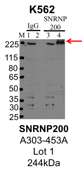 K562_Bethyl_A303-453A_1_SNRNP200.png<br>Caption: IP-Western Blot analysis of K562 whole cell lysate using SNRNP200 specific antibody. Lane 1 is 1% of twenty million whole cell lysate input and lane 2 is 25% of IP enrichment using rabbit normal IgG (lanes under 'IgG'). Lane 3 is 1% of twenty million whole cell lysate input and lane 4 is 10% IP enrichment using rabbit polyclonal anti-SNRNP200 antibody (lanes under 'SNRNP200').