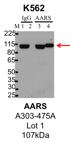 K562_Bethyl_A303-475A_1_AARS.png<br>Caption: IP-Western Blot analysis of K562 whole cell lysate using AARS specific antibody. Lane 1 is 1% of twenty million whole cell lysate input and lane 2 is 25% of IP enrichment using rabbit normal IgG (lanes under 'IgG'). Lane 3 is 1% of twenty million whole cell lysate input and lane 4 is 10% IP enrichment using rabbit polyclonal anti-AARS antibody (lanes under 'AARS').