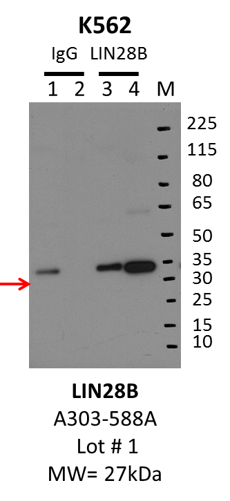 K562_Bethyl_A303-588A_1_LIN28B.png<br>Caption: IP-Western Blot analysis of K562 whole cell lysate using LIN28B specific antibody. Lane 1 is 1% of twenty million whole cell lysate input and lane 2 is 10% of IP enrichment using rabbit normal IgG (lanes under 'IgG'). Lane 3 is 1% of twenty million whole cell lysate input and lane 4 is 10% IP enrichment using rabbit polyclonal anti-LIN28B antibody (lanes under 'LIN28B').