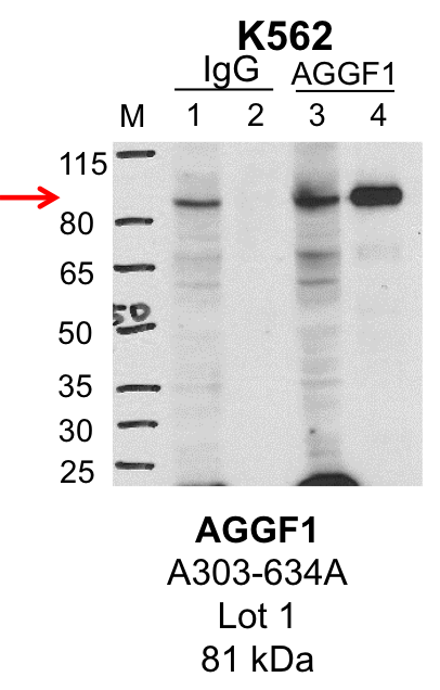 K562_Bethyl_A303-634A_1_AGGF1.png<br>Caption: IP-Western Blot analysis of K562 whole cell lysate using AGGF1 specific antibody. Lane 1 is 1% of twenty million whole cell lysate input and lane 2 is 25% of IP enrichment using rabbit normal IgG (lanes under 'IgG'). Lane 3 is 1% of twenty million whole cell lysate input and lane 4 is 10% IP enrichment using rabbit polyclonal anti-AGGF1 antibody (lanes under 'AGGF1').