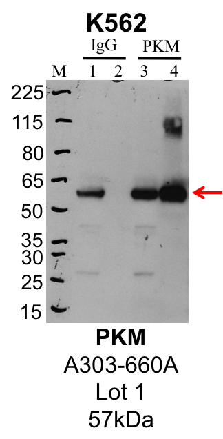 K562_Bethyl_A303-660A_1_PKM.png<br>Caption: IP-Western Blot analysis of K562 whole cell lysate using PKM specific antibody. Lane 1 is 1% of twenty million whole cell lysate input and lane 2 is 25% of IP enrichment using rabbit normal IgG (lanes under 'IgG'). Lane 3 is 1% of twenty million whole cell lysate input and lane 4 is 10% IP enrichment using rabbit polyclonal anti-PKM antibody (lanes under 'PKM').