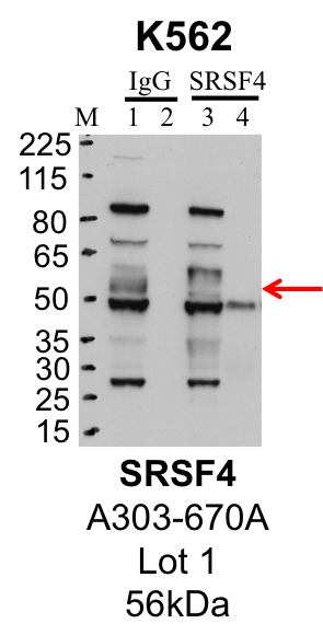 K562_Bethyl_A303-670A_1_SRSF4.png<br>Caption: IP-Western Blot analysis of K562 whole cell lysate using SRSF4 specific antibody. Lane 1 is 1% of twenty million whole cell lysate input; lane 2 is 10% of IP enrichment using rabbit normal IgG (lanes under 'lgG'); Lane 3 is 1% of twenty million whole cell lysate input and lane 4 is 10% IP enrichment using rabbit polyclonal anti-SRSF4 antibody (lanes under 'SRSF4').