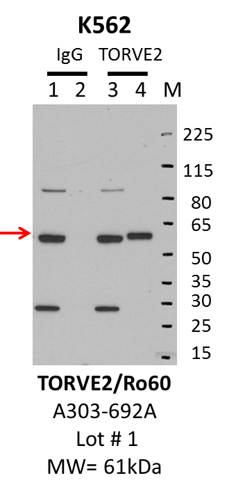 K562_Bethyl_A303-692A_1_TROVE2.png<br>Caption: IP-Western Blot analysis of K562 whole cell lysate using TROVE2 specific antibody. Lane 1 is 1% of twenty million whole cell lysate input and lane 2 is 10% of IP enrichment using rabbit normal IgG (lanes under 'IgG'). Lane 3 is 1% of twenty million whole cell lysate input and lane 4 is 10% IP enrichment using rabbit polyclonal anti-Ro60 antibody (lanes under 'TROVE2').