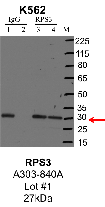 K562_Bethyl_A303-840A_1_RPS3.png<br>Caption: IP-Western Blot analysis of K562 whole cell lysate using RPS3 specific antibody. Lane 1 is 1% of twenty million whole cell lysate input and lane 2 is 25% of IP enrichment using rabbit normal IgG (lanes under 'IgG'). Lane 3 is 1% of twenty million whole cell lysate input and lane 4 is 10% IP enrichment using rabbit polyclonal anti-RPS3 antibody (lanes under 'RPS3').