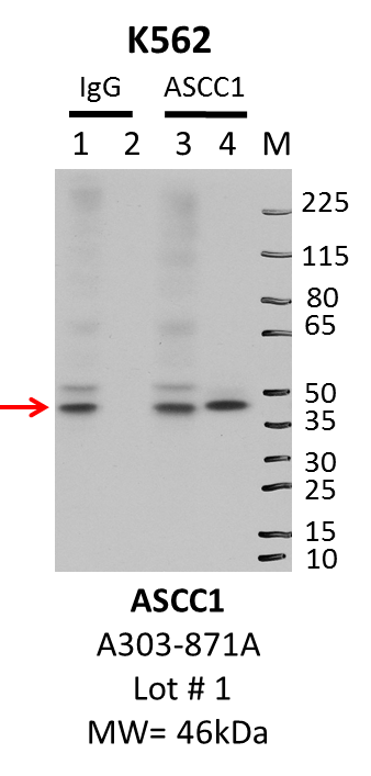 K562_Bethyl_A303-871A_1_ASCC1.png<br>Caption: IP-WB characterization of ASCC1 specific antibody in K562 cell line . Lane 1 is 2.5% of five million K562 whole cell lysate Input, lane 2 is 2.5% of supernatant after immunoprecipitation and Lane 3 is 50% of IP enrichment using rabbit polyclonal Rabbitanti-ASCC1Antibody. This antibody passes preliminary validation and will be further pursued for primary and secondary validation.