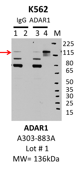 K562_Bethyl_A303-883A_1_ADAR1.png<br>Caption: IP-Western Blot analysis of K562 whole cell lysate using ADAR1 specific antibody. Lane 1 is 1% of twenty million whole cell lysate input and lane 2 is 10% of IP enrichment using rabbit normal IgG (lanes under 'IgG'). Lane 3 is 1% of twenty million whole cell lysate input and lane 4 is 10% IP enrichment using rabbit polyclonal anti-ADAR1 antibody (lanes under 'ADAR1').