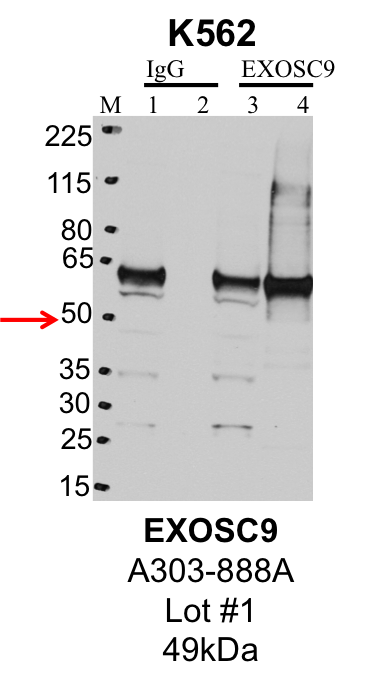 K562_Bethyl_A303-888A_1_EXOSC9.png<br>Caption: IP-Western Blot analysis of K562 whole cell lysate using PRPF8 specific antibody. Lane 1 is 1% of twenty million whole cell lysate input and lane 2 is 25% of IP enrichment using rabbit normal IgG (lanes under 'IgG'). Lane 3 is 1% of twenty million whole cell lysate input and lane 4 is 10% IP enrichment using rabbit polyclonal anti-PRPF8 antibody (lanes under 'PRPF8').