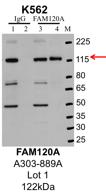 K562_Bethyl_A303-889A_1_FAM120A.png<br>Caption: IP-Western Blot analysis of K562 whole cell lysate using FAM120A specific antibody. Lane 1 is 1% of twenty million whole cell lysate input and lane 2 is 25% of IP enrichment using rabbit normal IgG (lanes under 'IgG'). Lane 3 is 1% of twenty million whole cell lysate input and lane 4 is 10% IP enrichment using rabbit polyclonal anti-FAM120A antibody (lanes under 'FAM120A').