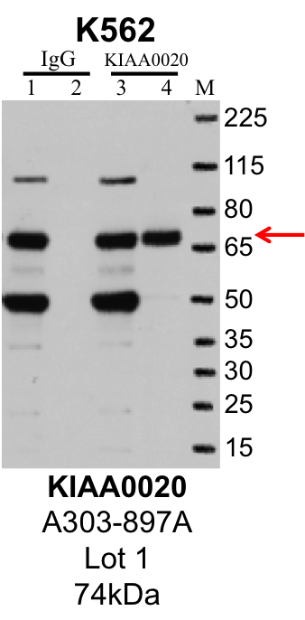 K562_Bethyl_A303-897_1_KIAA0020.png<br>Caption: IP-Western Blot analysis of K562 whole cell lysate using KIAA0020 specific antibody. Lane 1 is 1% of twenty million whole cell lysate input and lane 2 is 10% of IP enrichment using rabbit normal IgG (lanes under 'IgG'). Lane 3 is 1% of twenty million whole cell lysate input and lane 4 is 10% IP enrichment using rabbit polyclonal anti-KIAA0020 antibody (lanes under 'KIAA0020').