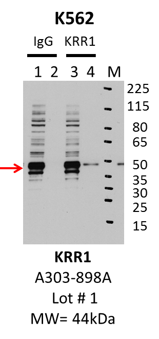 K562_Bethyl_A303-898A_1_KRR1.png<br>Caption: IP-Western Blot analysis of K562 whole cell lysate using KRR1 specific antibody. Lane 1 is 1% of twenty million whole cell lysate input and lane 2 is 10% of IP enrichment using rabbit normal IgG (lanes under 'IgG'). Lane 3 is 1% of twenty million whole cell lysate input and lane 4 is 10% IP enrichment using rabbit polyclonal anti-KRR1 antibody (lanes under 'KRR1').