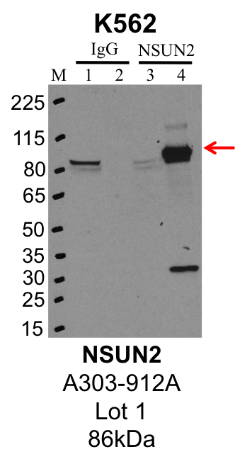 K562_Bethyl_A303-912A_1_NSUN2.png<br>Caption: IP-Western Blot analysis of K562 whole cell lysate using NSUN2 specific antibody. Lane 1 is 1% of twenty million whole cell lysate input and lane 2 is 25% of IP enrichment using rabbit normal IgG (lanes under 'IgG'). Lane 3 is 1% of twenty million whole cell lysate input and lane 4 is 10% IP enrichment using rabbit polyclonal anti-NSUN2 antibody (lanes under 'NSUN2').