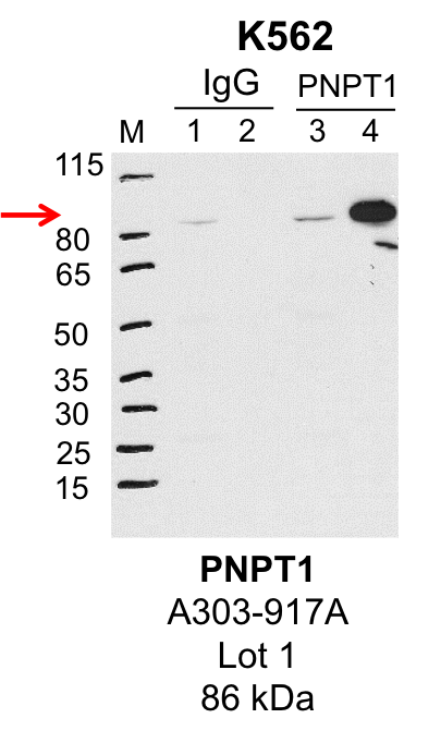 K562_Bethyl_A303-917A_1_PNPT1.png<br>Caption: IP-Western Blot analysis of K562 whole cell lysate using PNPT1 specific antibody. Lane 1 is 1% of twenty million whole cell lysate input and lane 2 is 25% of IP enrichment using rabbit normal IgG (lanes under 'IgG'). Lane 3 is 1% of twenty million whole cell lysate input and lane 4 is 10% IP enrichment using rabbit polyclonal anti-PNPT1 antibody (lanes under 'PNPT1').