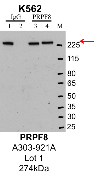 K562_Bethyl_A303-921A_1_PRPF8.png<br>Caption: IP-Western Blot analysis of K562 whole cell lysate using PRPF8 specific antibody. Lane 1 is 1% of twenty million whole cell lysate input and lane 2 is 25% of IP enrichment using rabbit normal IgG (lanes under 'IgG'). Lane 3 is 1% of twenty million whole cell lysate input and lane 4 is 10% IP enrichment using rabbit polyclonal anti-PRPF8 antibody (lanes under 'PRPF8').