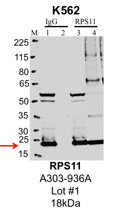 K562_Bethyl_A303-936A_1_RPS11.png<br>Caption: IP-Western Blot analysis of K562 whole cell lysate using RPS11 specific antibody. Lane 1 is 1% of twenty million whole cell lysate input and lane 2 is 25% of IP enrichment using rabbit normal IgG (lanes under 'IgG'). Lane 3 is 1% of twenty million whole cell lysate input and lane 4 is 10% IP enrichment using rabbit polyclonal anti-RPS11 antibody (lanes under 'RPS11').