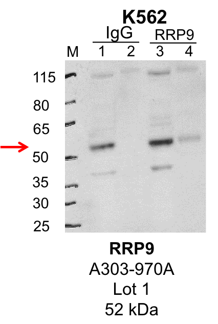 K562_Bethyl_A303-970A_1_RRP9.png<br>Caption: IP-Western Blot analysis of K562 whole cell lysate using RRP9 specific antibody. Lane 1 is 1% of twenty million whole cell lysate input and lane 2 is 25% of IP enrichment using rabbit normal IgG (lanes under 'IgG'). Lane 3 is 1% of twenty million whole cell lysate input and lane 4 is 10% IP enrichment using rabbit polyclonal anti-RRP9 antibody (lanes under 'RRP9').