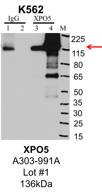 K562_Bethyl_A303-991A_1_XPO5.png<br>Caption: IP-Western Blot analysis of K562 whole cell lysate using XPO5 specific antibody. Lane 1 is 1% of twenty million whole cell lysate input and lane 2 is 25% of IP enrichment using rabbit normal IgG (lanes under 'IgG'). Lane 3 is 1% of twenty million whole cell lysate input and lane 4 is 10% IP enrichment using rabbit polyclonal anti-XPO5 antibody (lanes under 'XPO5').