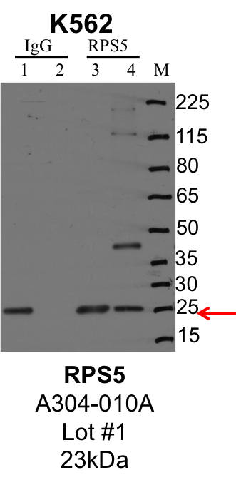 K562_Bethyl_A304-010A_1_RPS5.png<br>Caption: IP-Western Blot analysis of K562 whole cell lysate using RPS5-specific antibody. Lane 1 is 1% of twenty million whole cell lysate input and lane 2 is 25% of IP enrichment using rabbit normal IgG (lanes under 'IgG'). Lane 3 is 1% of twenty million whole cell lysate input and lane 4 is 10% IP enrichment using rabbit polyclonal anti-RPS5 antibody (lanes under 'RPS5').