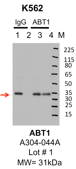 K562_Bethyl_A304-044A_1_ABT1.png<br>Caption: IP-Western Blot analysis of K562 whole cell lysate using ABT1 specific antibody. Lane 1 is 1% of twenty million whole cell lysate input and lane 2 is 25% of IP enrichment using rabbit normal IgG (lanes under 'IgG'). Lane 3 is 1% of twenty million whole cell lysate input and lane 4 is 10% IP enrichment using rabbit polyclonal anti-ABT1 antibody (lanes under 'ABT1').