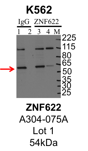 K562_Bethyl_A304-075A_1_ZNF622.png<br>Caption: IP-Western Blot analysis of K562 whole cell lysate using ZNF622 specific antibody. Lane 1 is 1% of twenty million whole cell lysate input and lane 2 is 25% of IP enrichment using rabbit normal IgG (lanes under 'IgG'). Lane 3 is 1% of twenty million whole cell lysate input and lane 4 is 10% IP enrichment using rabbit polyclonal anti-ZNF622 antibody (lanes under 'ZNF622').