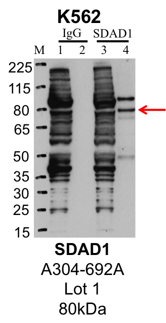 K562_Bethyl_A304-692A_1_SDAD1.png<br>Caption: IP-Western Blot analysis of K562 whole cell lysate using SDAD1 specific antibody. Lane 1 is 1% of twenty million whole cell lysate input and lane 2 is 25% of IP enrichment using rabbit normal IgG (lanes under 'IgG'). Lane 3 is 1% of twenty million whole cell lysate input and lane 4 is 10% IP enrichment using rabbit polyclonal anti-SDAD1 antibody (lanes under 'SDAD1').