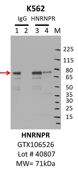 K562_GeneTex_GTX106526_40807_HNRNPR.png<br>Caption: IP-Western Blot analysis of K562 whole cell lysate using HNRNPR specific antibody. Lane 1 is 1% of twenty million whole cell lysate input and lane 2 is 10% of IP enrichment using rabbit normal IgG (lanes under 'IgG'). Lane 3 is 1% of twenty million whole cell lysate input and lane 4 is 10% IP enrichment using rabbit polyclonal hnRNPR antibody [N1N2] (lanes under 'HNRNPR').