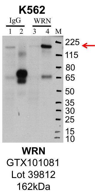 K562_Genetex_GTX101081_39812_WRN.png<br>Caption: IP-Western Blot analysis of K562 whole cell lysate using WRN specific antibody. Lane 1 is 1% of twenty million whole cell lysate input and lane 2 is 25% of IP enrichment using rabbit normal IgG (lanes under 'IgG'). Lane 3 is 1% of twenty million whole cell lysate input and lane 4 is 10% IP enrichment using rabbit polyclonal anti-WRN antibody (lanes under 'WRN').