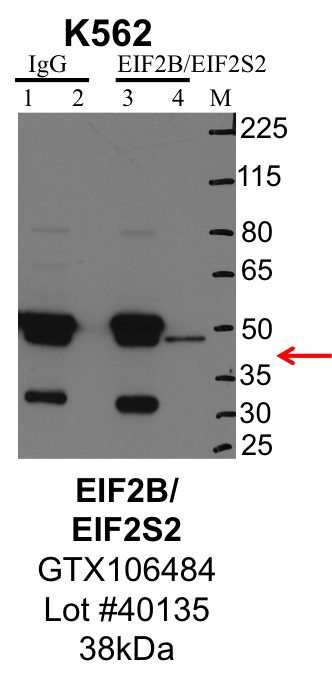 K562_Genetex_GTX106484_40135_EIF2B.png<br>Caption: IP-Western Blot analysis of K562 whole cell lysate using EIF2B specific antibody. Lane 1 is 1% of twenty million whole cell lysate input and lane 2 is 25% of IP enrichment using rabbit normal IgG (lanes under 'IgG'). Lane 3 is 1% of twenty million whole cell lysate input and lane 4 is 10% IP enrichment using rabbit polyclonal anti-EIF2B antibody (lanes under 'EIF2B').