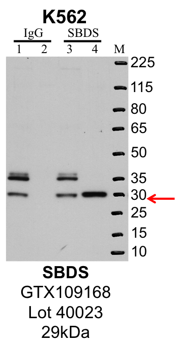 K562_Genetex_GTX109168_40023_SBDS.png<br>Caption: IP-Western Blot analysis of K562 whole cell lysate using SBDS specific antibody. Lane 1 is 1% of twenty million whole cell lysate input and lane 2 is 25% of IP enrichment using rabbit normal IgG (lanes under 'IgG'). Lane 3 is 1% of twenty million whole cell lysate input and lane 4 is 10% IP enrichment using rabbit polyclonal anti-SBDS antibody (lanes under 'SBDS').