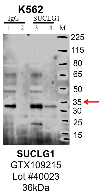 K562_Genetex_GTX109215_40023_SUCLG1.png<br>Caption: IP-Western Blot analysis of K562 whole cell lysate using SUCLG1 specific antibody. Lane 1 is 1% of twenty million whole cell lysate input and lane 2 is 25% of IP enrichment using rabbit normal IgG (lanes under 'IgG'). Lane 3 is 1% of twenty million whole cell lysate input and lane 4 is 10% IP enrichment using rabbit polyclonal anti-SUCLG1 antibody (lanes under 'SUCLG1').