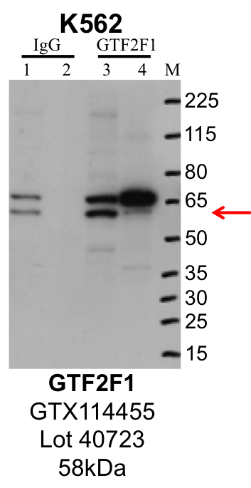 K562_Genetex_GTX114455_40723_GTF2F1.png<br>Caption: IP-Western Blot analysis of K562 whole cell lysate using GTF2F1 specific antibody. Lane 1 is 1% of twenty million whole cell lysate input and lane 2 is 25% of IP enrichment using rabbit normal IgG (lanes under 'IgG'). Lane 3 is 1% of twenty million whole cell lysate input and lane 4 is 10% IP enrichment using rabbit polyclonal anti-GTF2F1 antibody (lanes under 'GTF2F1').